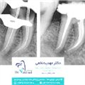لوگوی دکتر مهدیه نخعی - متخصص ریشه دندان