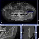لوگوی رادیولوژی دکتر فرزانه مومنی - رادیولوژی دهان و دندان