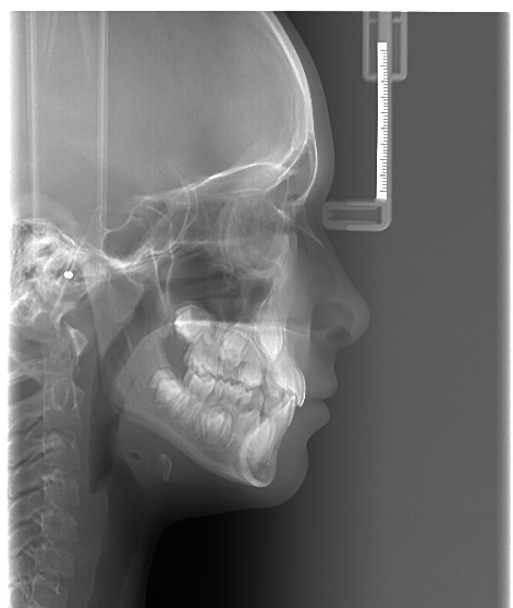 صالحی میلانی - رادیولوژی دهان و دندان شماره 2