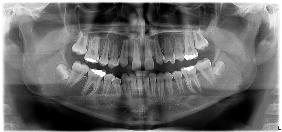 صالحی میلانی - رادیولوژی دهان و دندان شماره 3