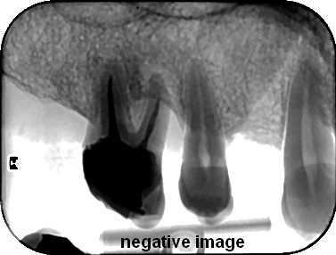 صالحی میلانی - رادیولوژی دهان و دندان شماره 5