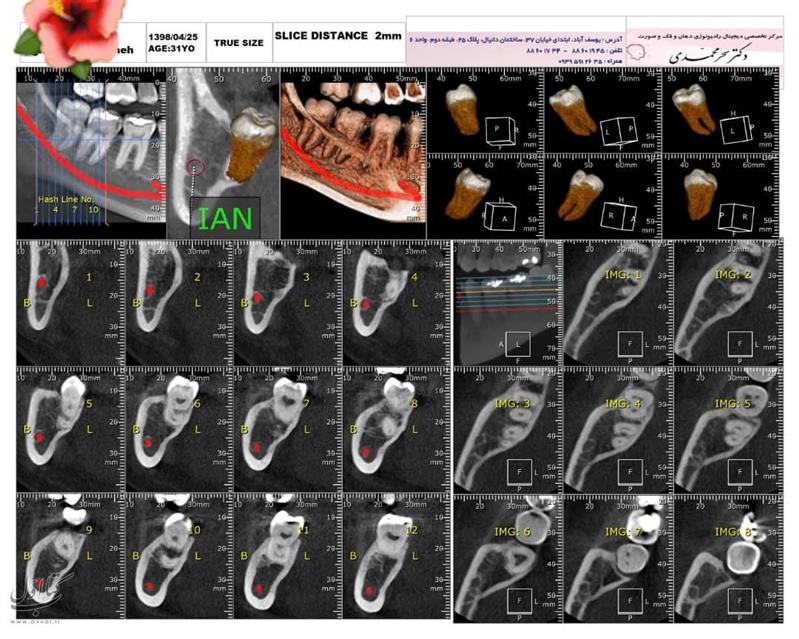 رادیولوژی رایان پرتو - دکتر سحرمحمدی - رادیولوژی دهان و دندان شماره 6