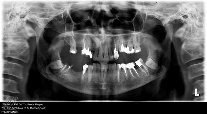 رادیولوژی رایان پرتو - دکتر سحرمحمدی - رادیولوژی دهان و دندان شماره 4