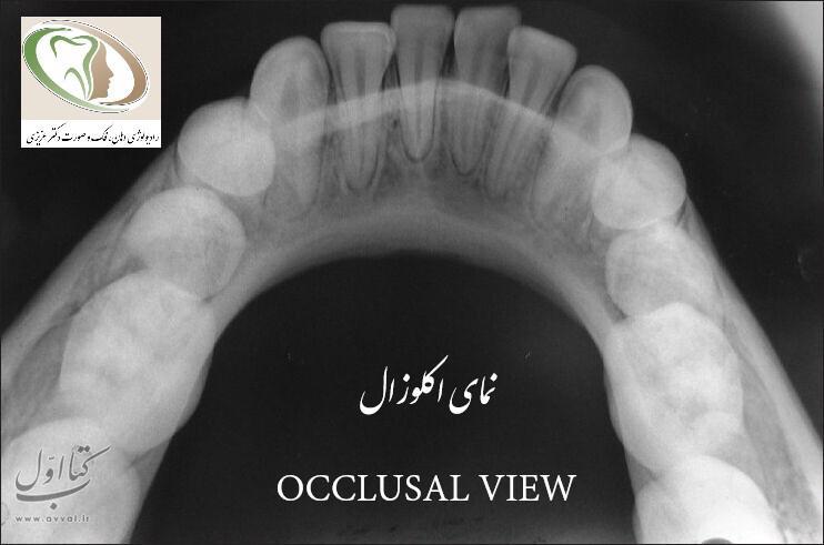 دکتر زینب عزیزی - رادیولوژی دهان و دندان شماره 12