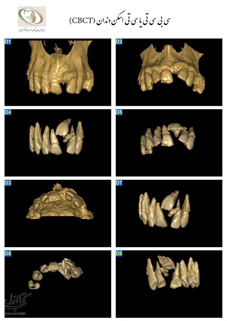 دکتر زینب عزیزی - رادیولوژی دهان و دندان شماره 16