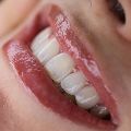 لوگوی کلینیک نسیم - کلینیک دندانپزشکی