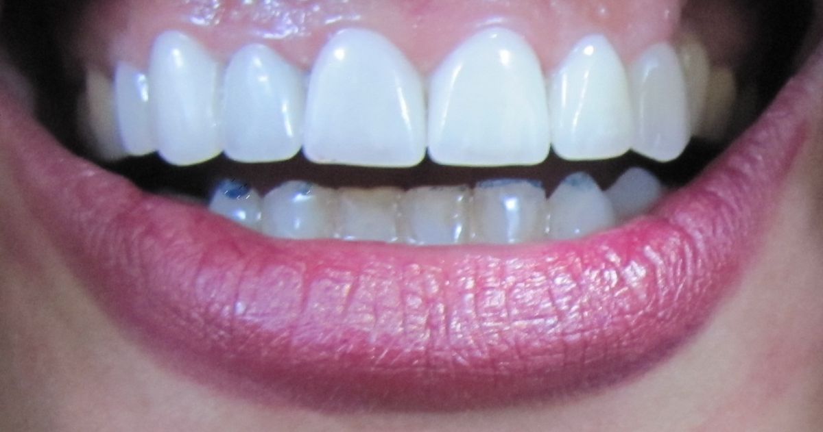 دندانپزشکی سپیتا لبخند - کلینیک دندانپزشکی شماره 1