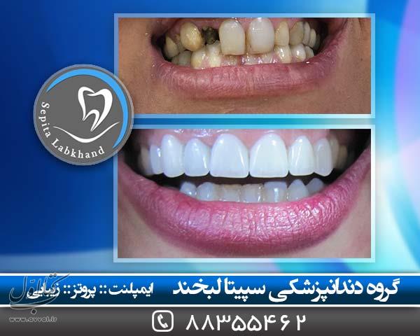 دندانپزشکی سپیتا لبخند - کلینیک دندانپزشکی شماره 5
