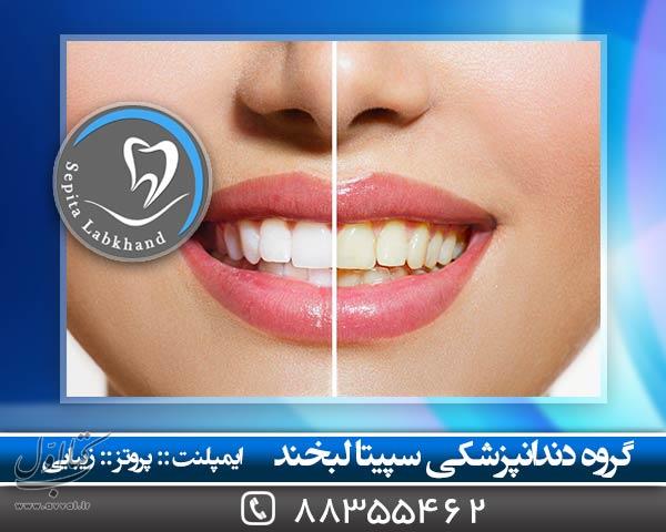 دندانپزشکی سپیتا لبخند - کلینیک دندانپزشکی شماره 8
