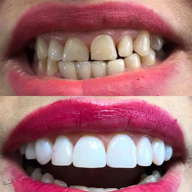 کلینیک دندانپزشکی دکتر میترا وثوقی - متخصص ریشه دندان شماره 10