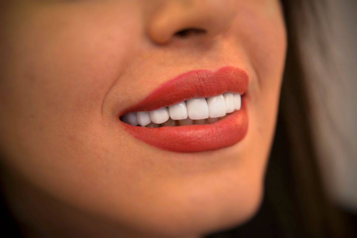 دکتر آخوندی - متخصص دندانپزشکی ترمیمی و زیبایی شماره 10