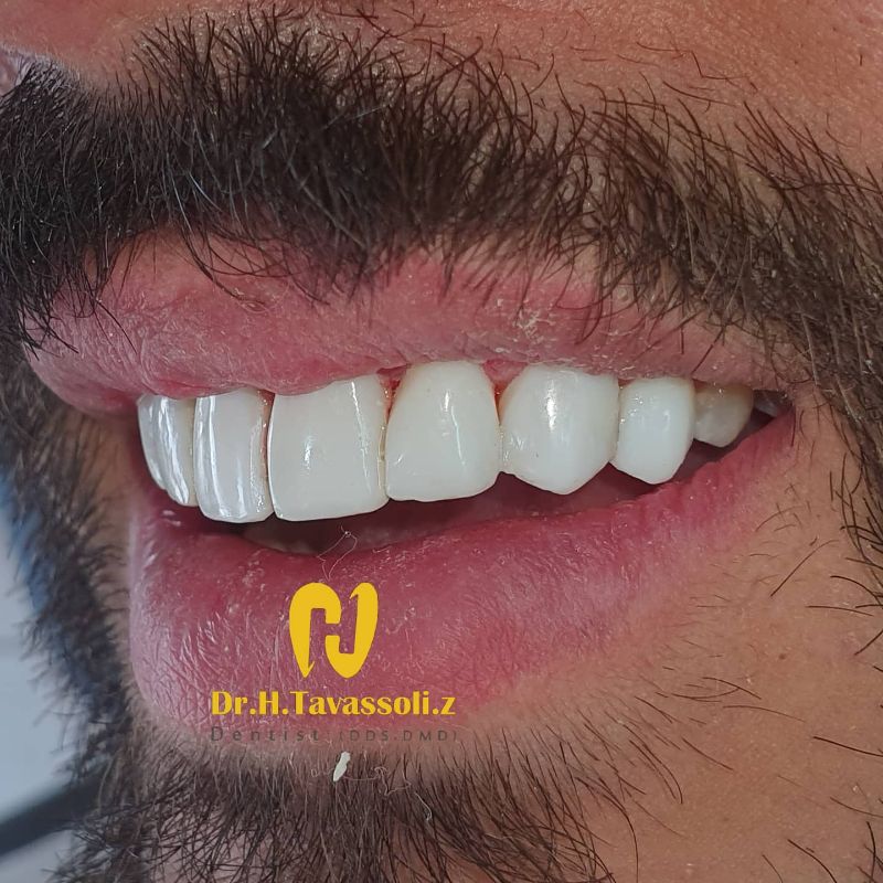 دکتر حسین توسلی زاده - متخصص دندانپزشکی ترمیمی و زیبایی شماره 4