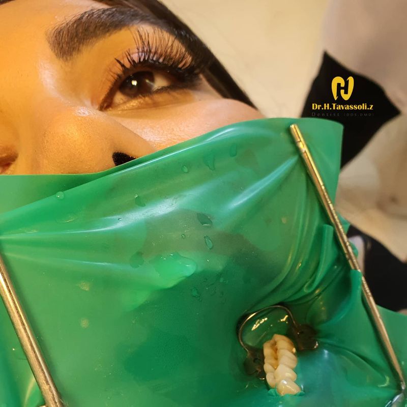 دکتر حسین توسلی زاده - متخصص دندانپزشکی ترمیمی و زیبایی شماره 7